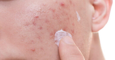 What Are The Uses Of Acne Cream